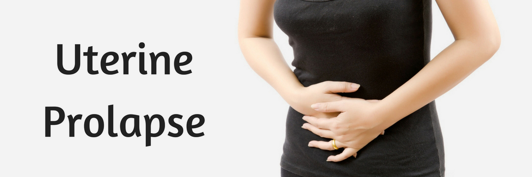 What Is A Uterine Prolapse