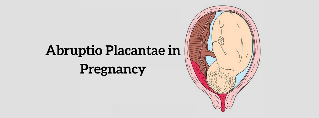 Watch out for Abruptio Placantae in Pregnancy