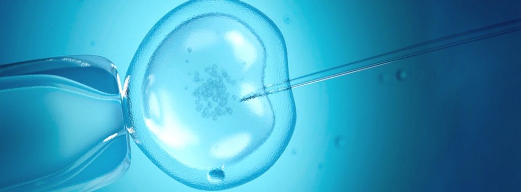 How much do you know about Intracytoplasmic Sperm Injection (ICSI)?