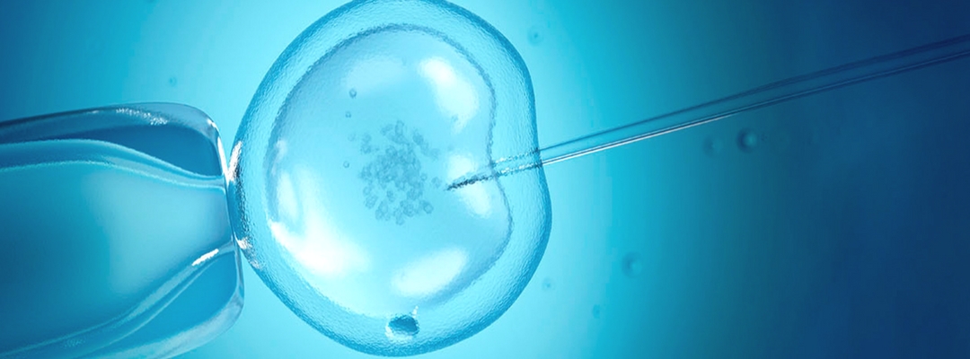 How much do you know about Intracytoplasmic Sperm Injection (ICSI)?