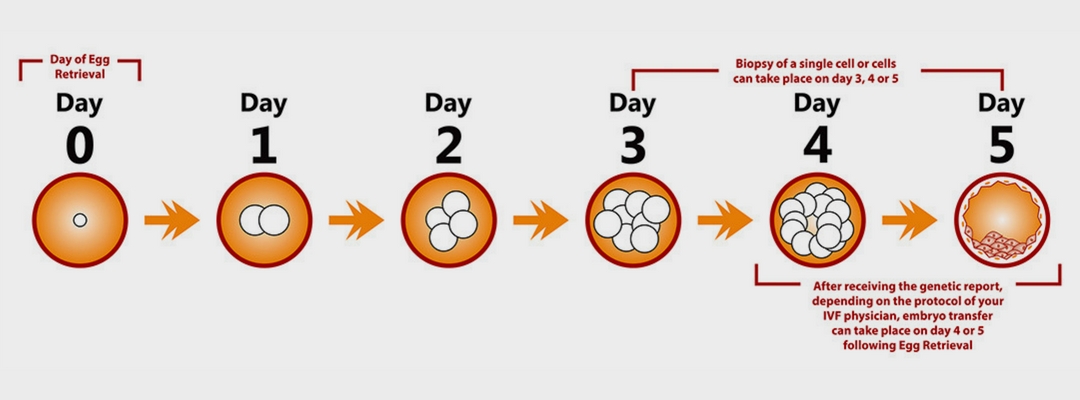 preimplantation genetic diagnosis