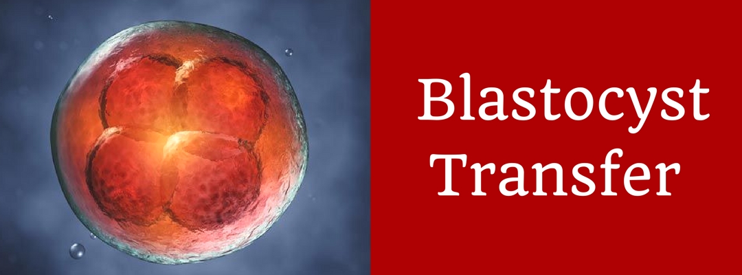 Why is Blastocyst Transfer better than a day 3 Transfer?