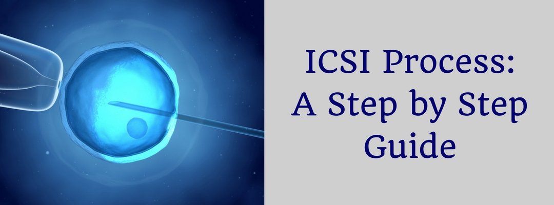 ICSI Treatment Process: A Step by Step Guide