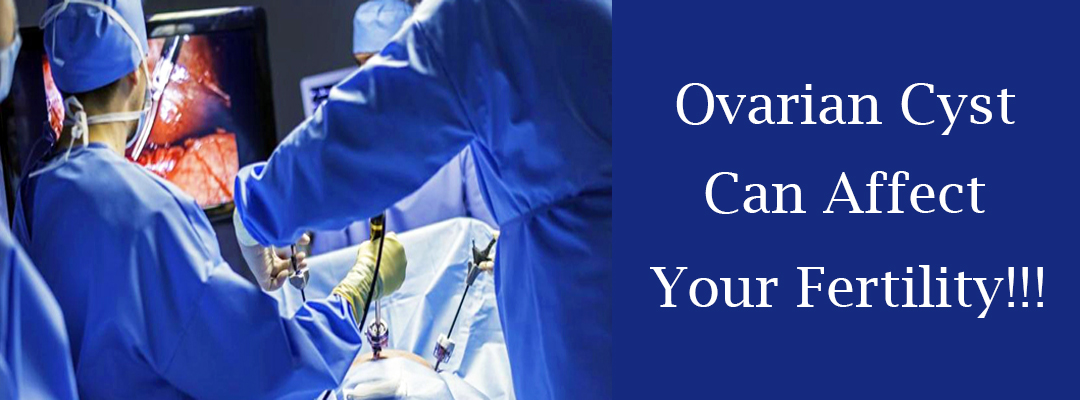 How are Ovarian Cysts cured by the Laparoscopy?